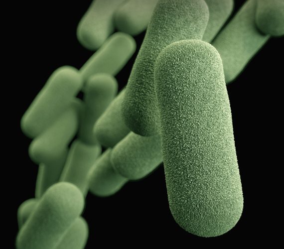E. coli strain